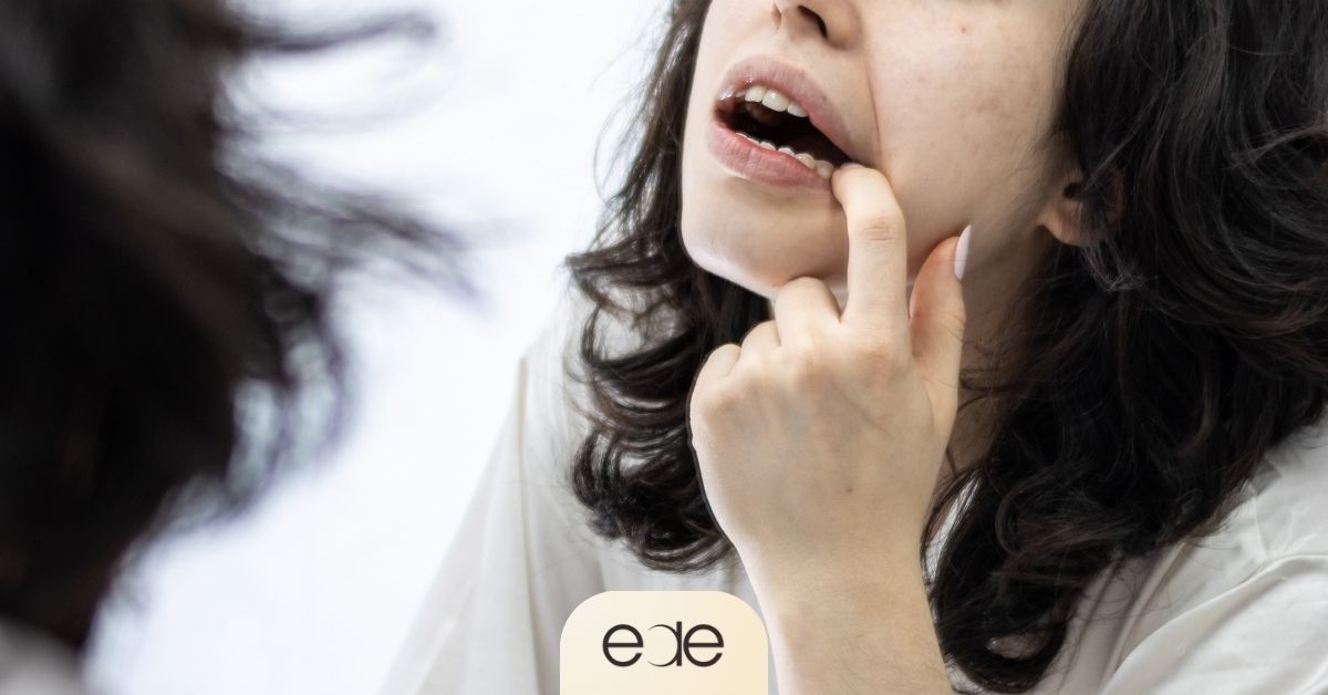 Person examining a tooth in a mirror after noticing signs of a cavity that may require professional dental treatment