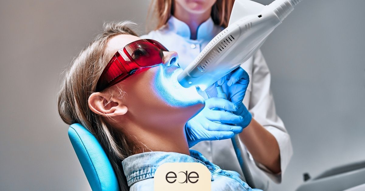  Professional whitening treatment using advanced light technology