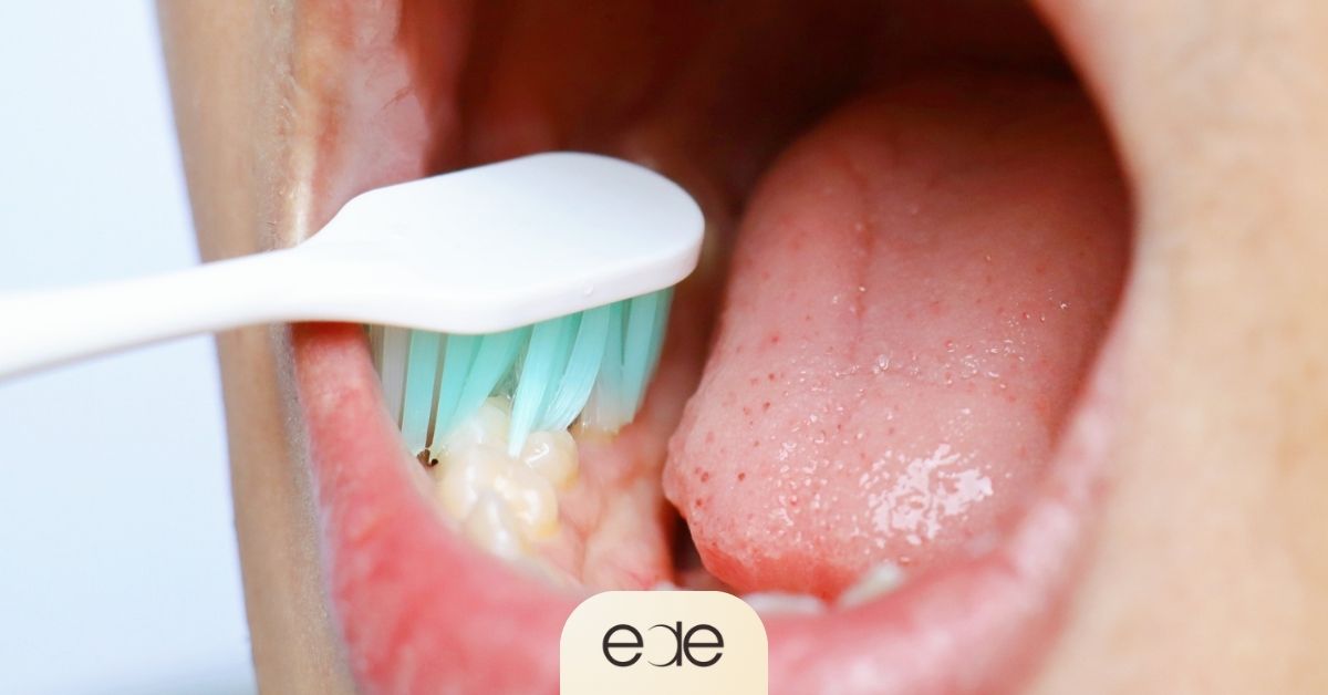 Close-up of aggressive tooth brushing contributing to gum recession and cold tooth sensitivity
