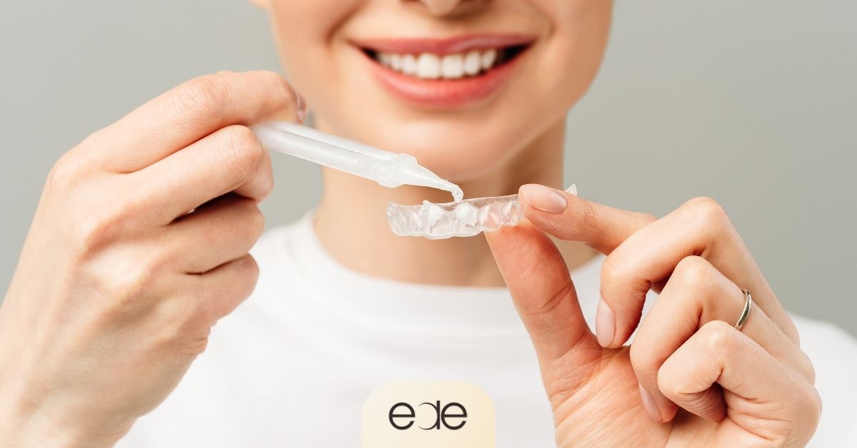 A woman applying whitening gel from a syringe into a clear dental tray, demonstrating how to use at-home teeth whitening kits safely.