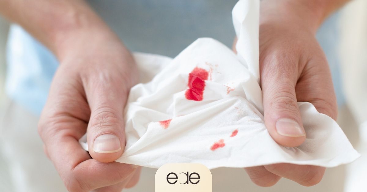 Bleeding after a tooth extraction before air travel.