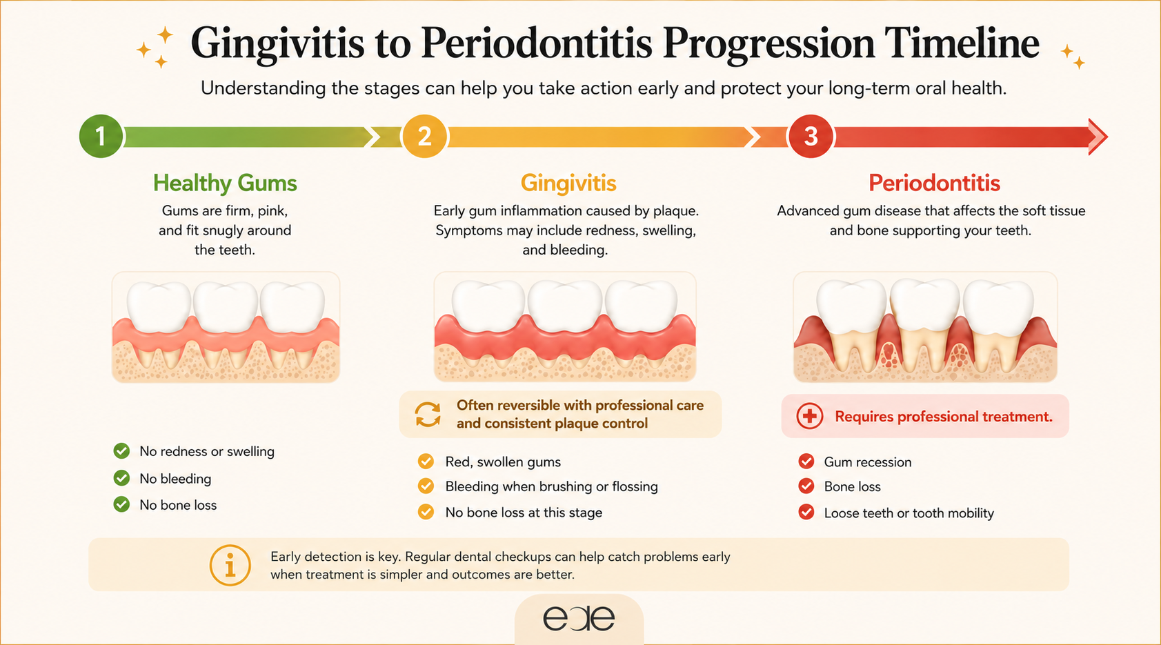 Educational timeline illustrating the stages of gum disease, from healthy gums through gingivitis to advanced periodontitis.