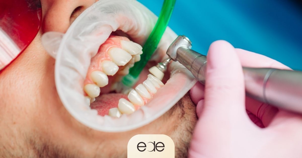  Dentist performing a professional dental cleaning as part of gum disease treatment. 