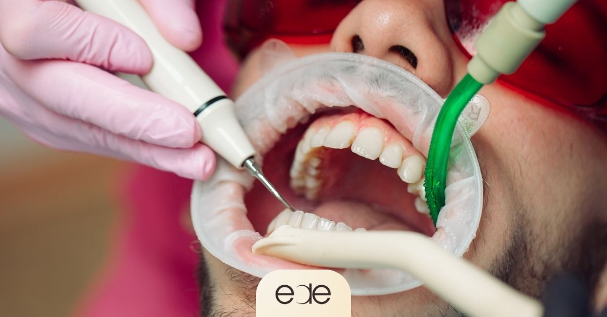 Dentist using an ultrasonic scaler to remove tartar from a patient’s teeth.