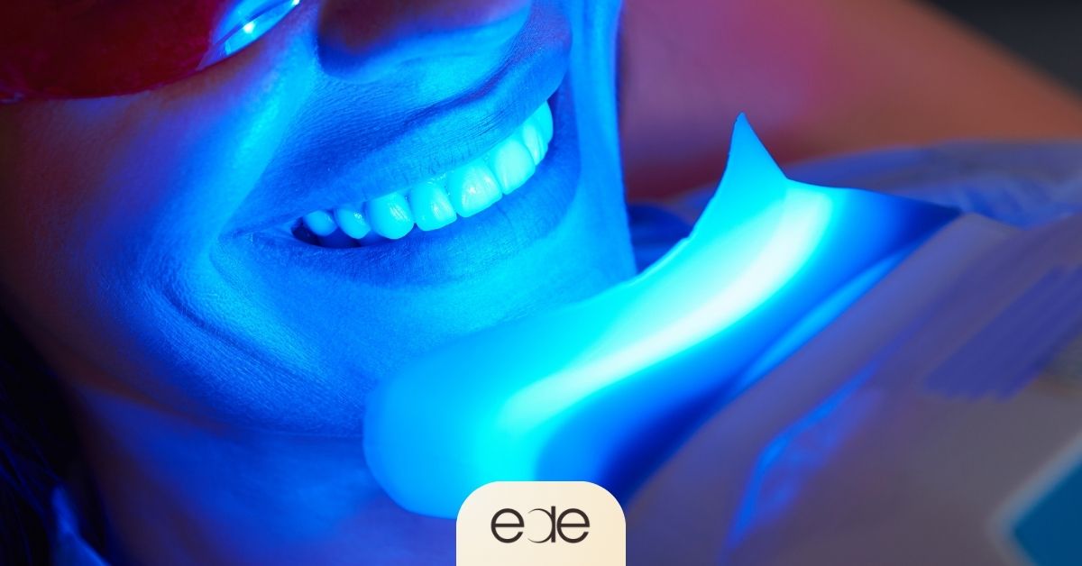 Close-up of a patient undergoing a professional teeth whitening treatment.