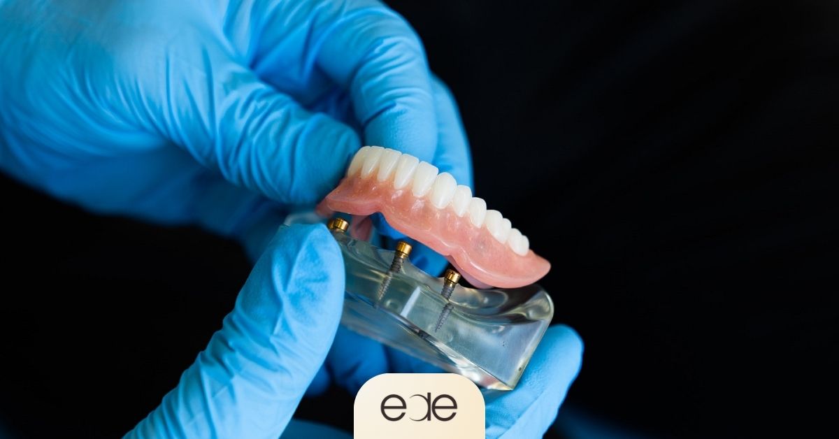Dentist holding implant-supported dentures designed for secure tooth replacement