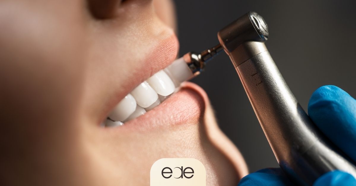 Dental professional performing a dental cleaning treatment to help protect teeth from future decay and cavity development