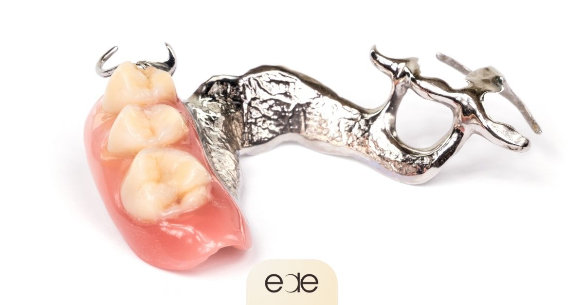 Close-up of a partial dental appliance for replacing several missing teeth