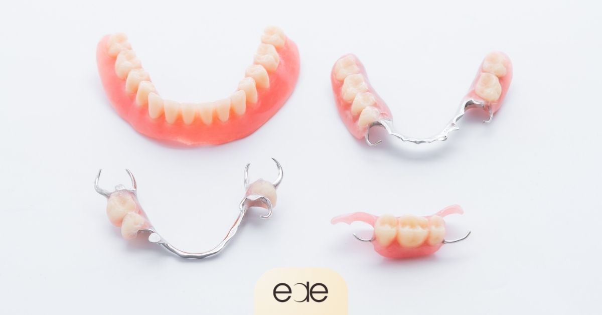 Full and partial dentures displayed as removable tooth replacement options