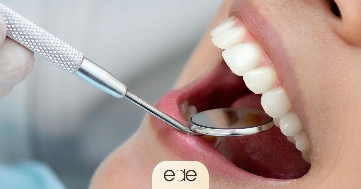 Dental examination of a patient’s teeth and gums before a deep cleaning.